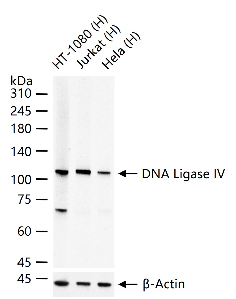 DNA连接酶4重组兔单抗