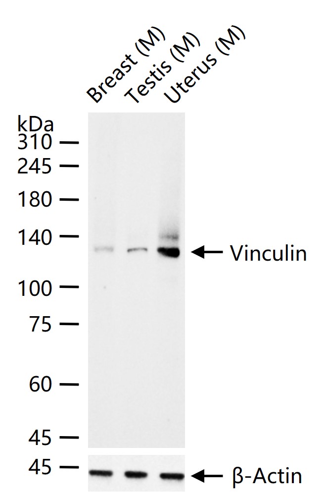 粘着斑蛋白（内参）重组兔单抗