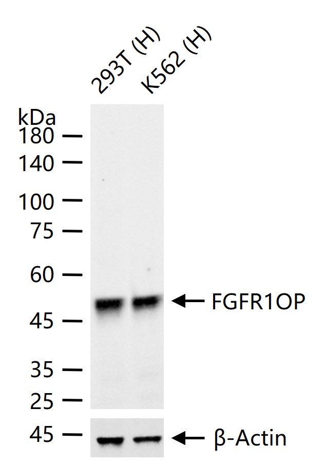 FGFR1OP Recombinant Rabbit mAb (一抗) - WB,ICC/IF | Bioss