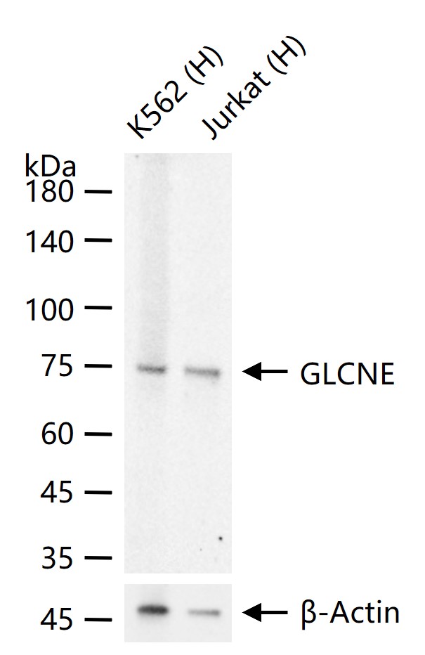 GLCNE Recombinant Rabbit mAb (一抗) - WB,ICC/IF | Bioss