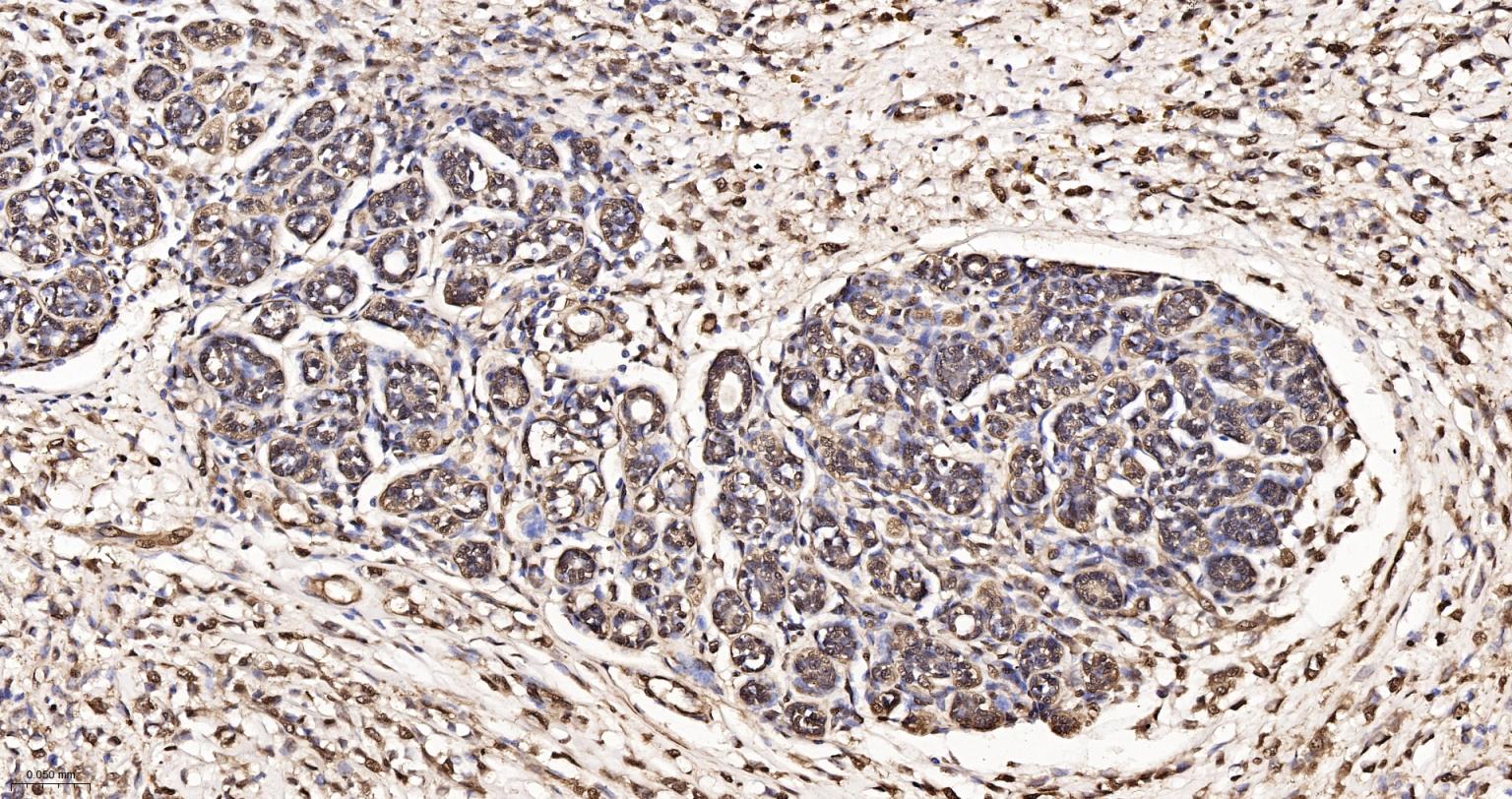 3-磷酸甘油醛脱氢酶(内参)重组兔单抗