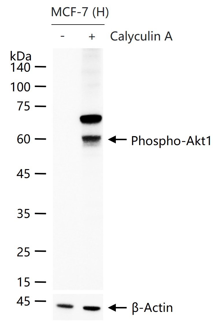 phospho-AKT1 (Ser473) Rabbit pAb (一抗) - WB | Bioss