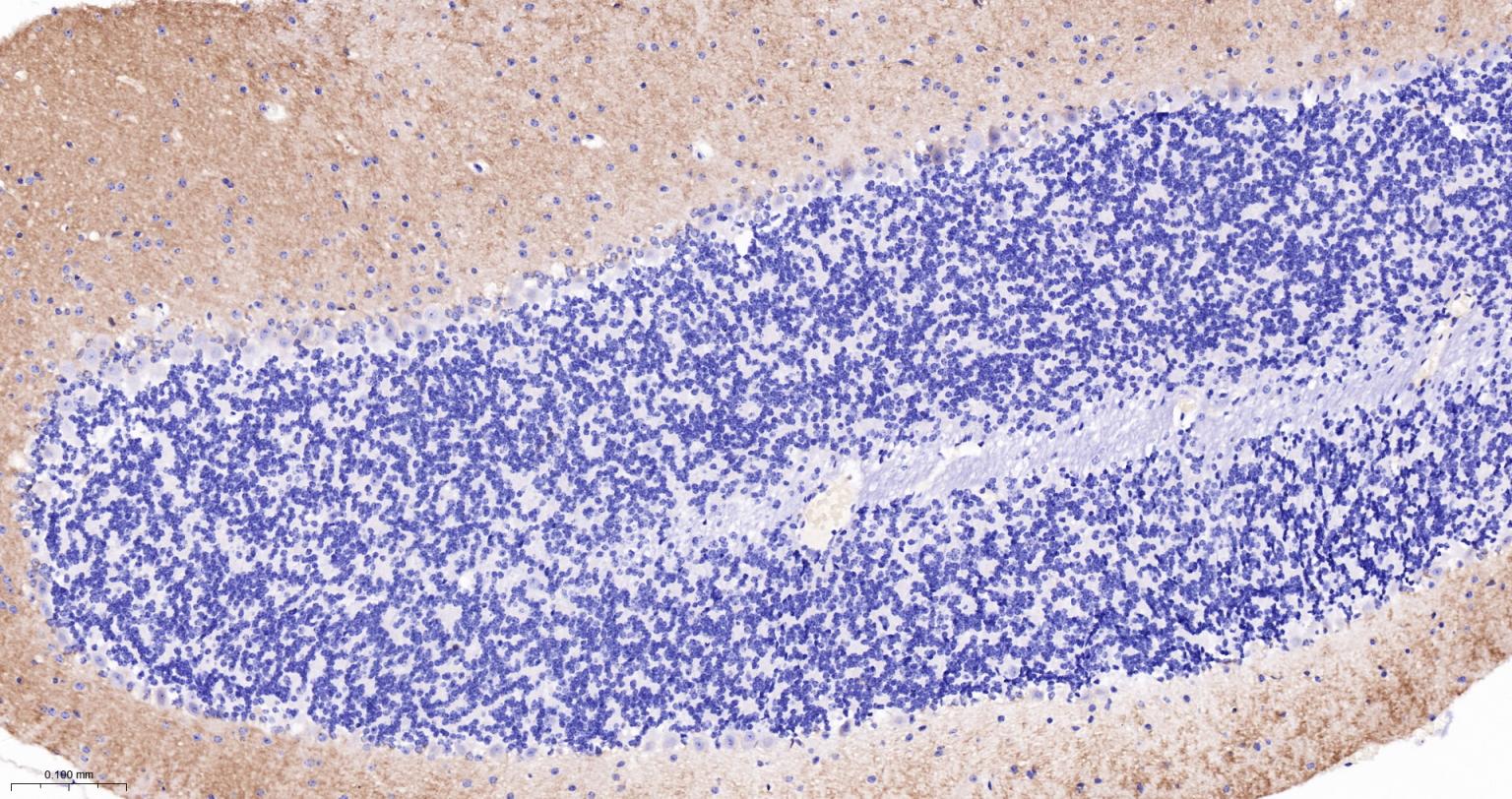 谷氨酸受体1重组兔单抗