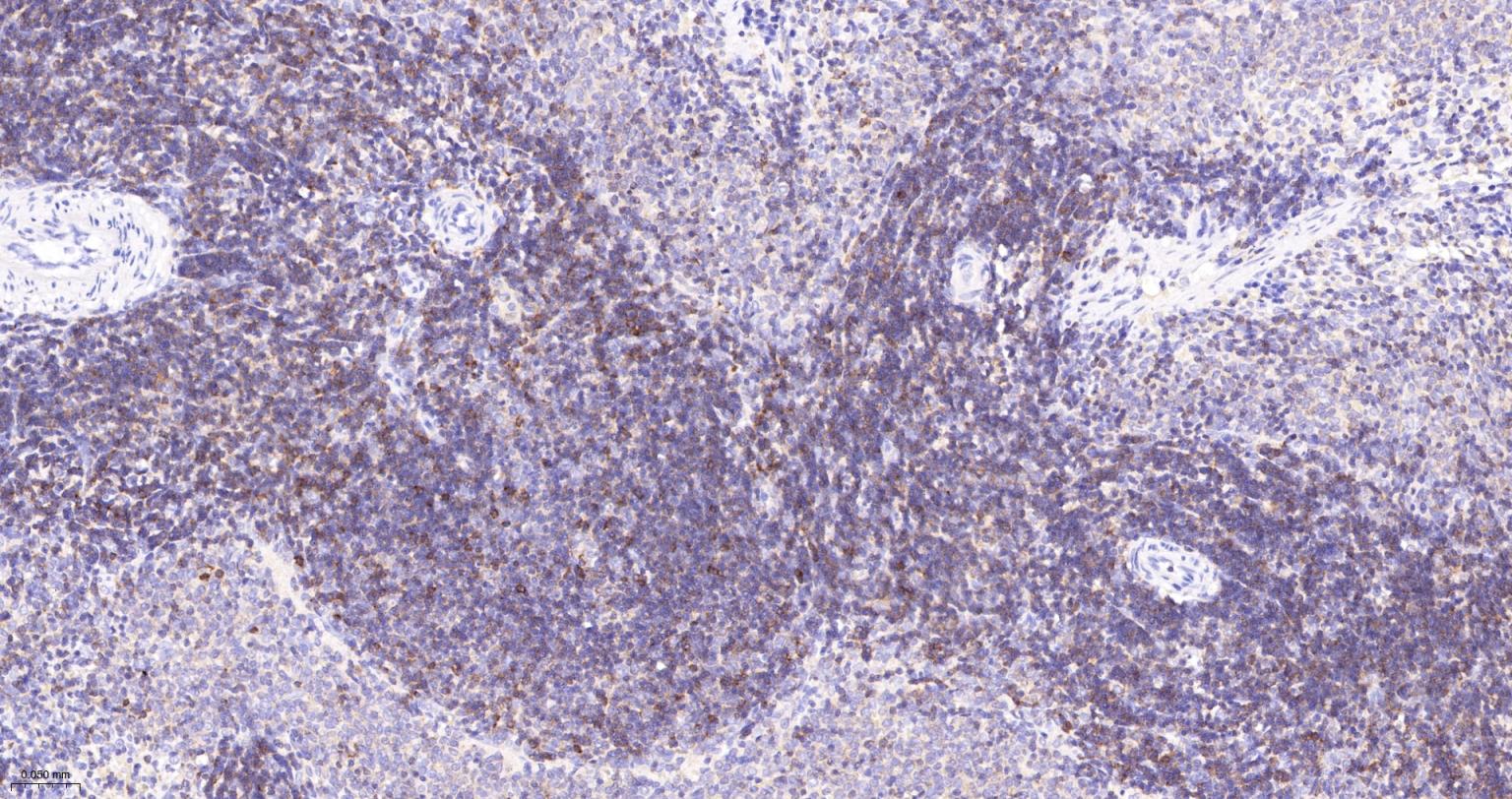 埃兹蛋白重组兔单抗-bsm-61424R