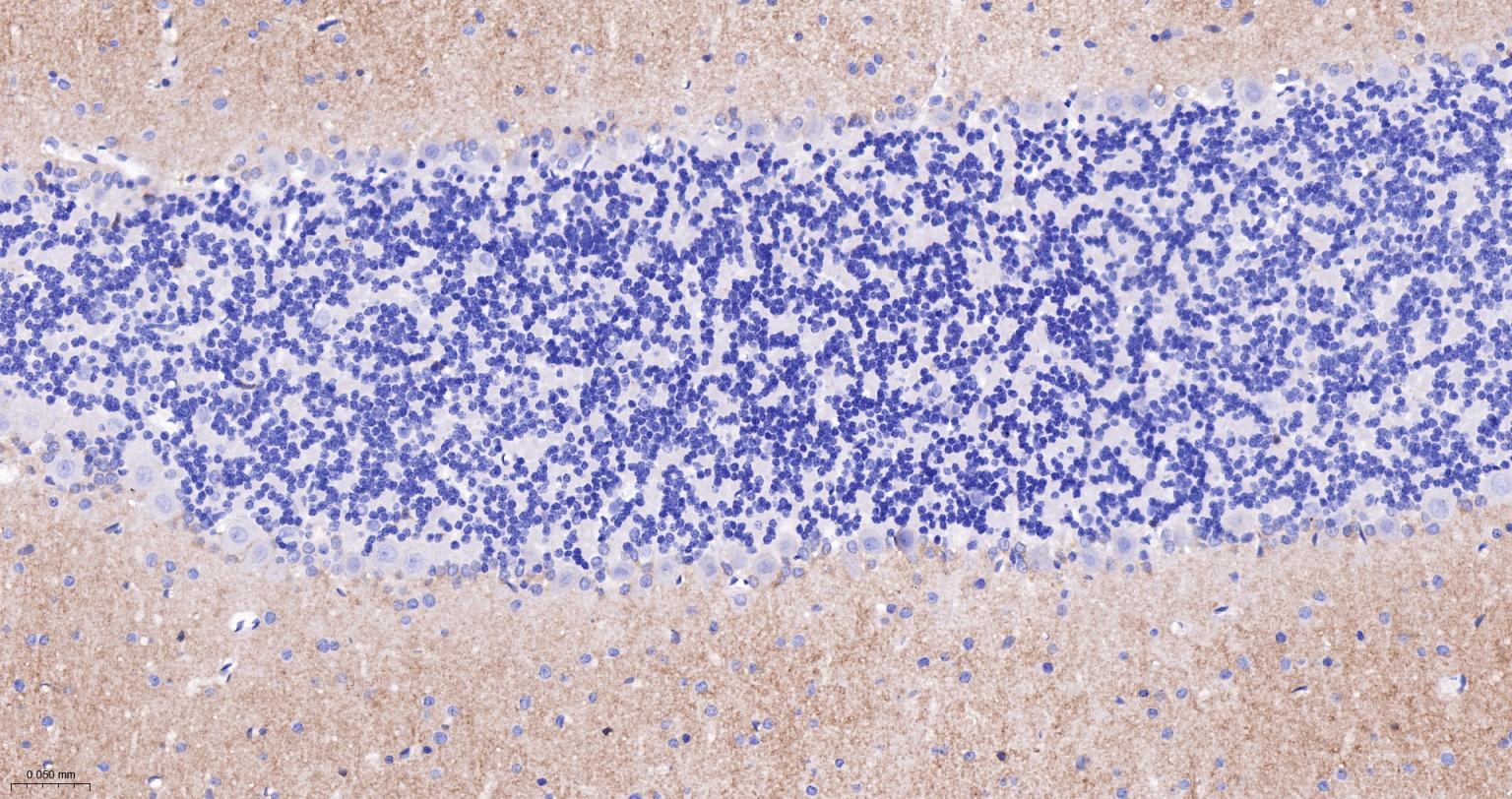 谷氨酸受体1重组兔单抗