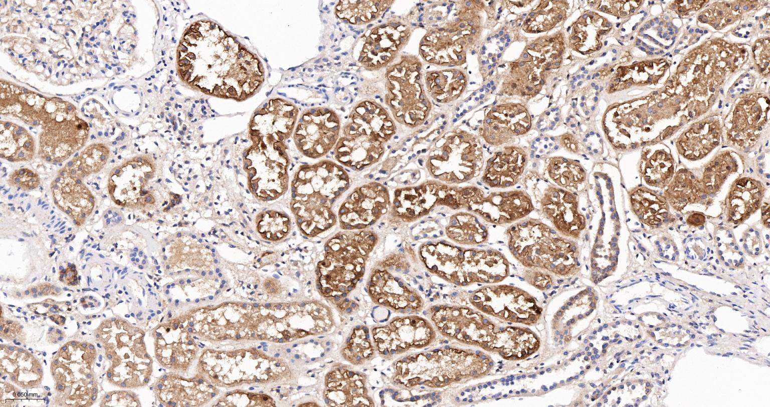 埃兹蛋白重组兔单抗-bsm-61424R