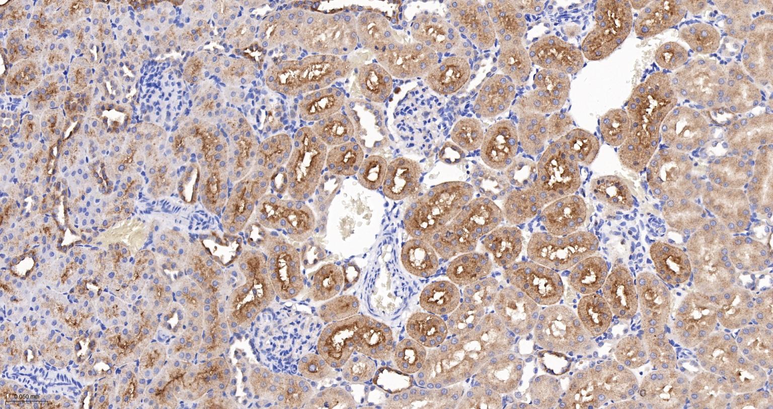 埃兹蛋白重组兔单抗-bsm-61424R
