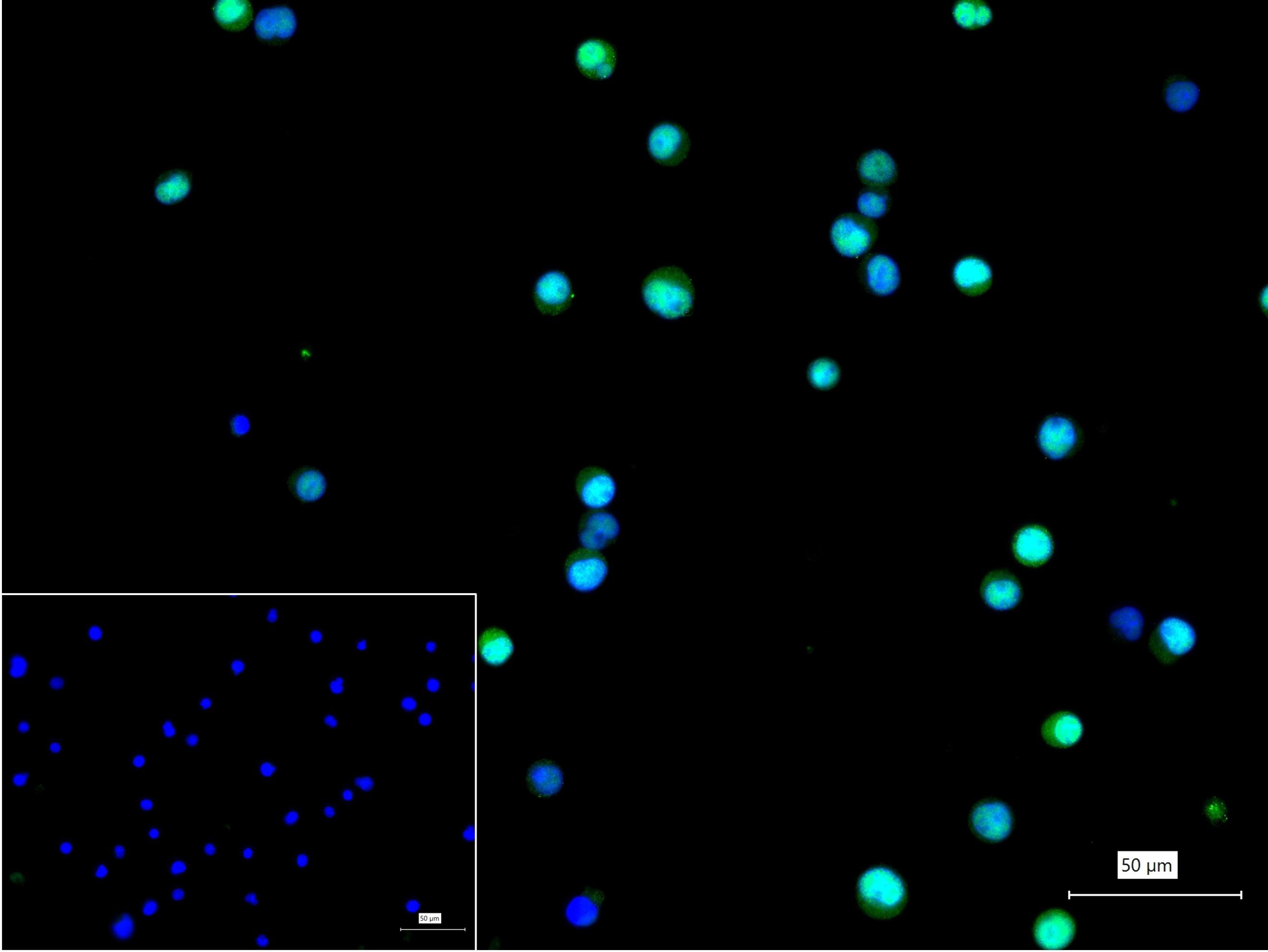 缺氧诱导因子1α抑制蛋白/HIF1AN重组兔单抗