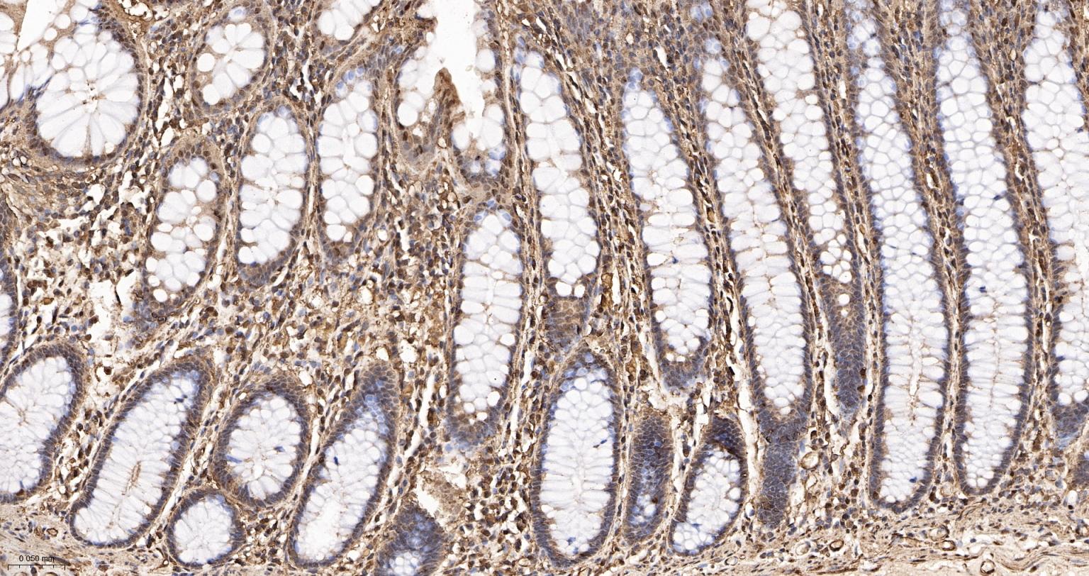 3-磷酸甘油醛脱氢酶(内参)重组兔单抗