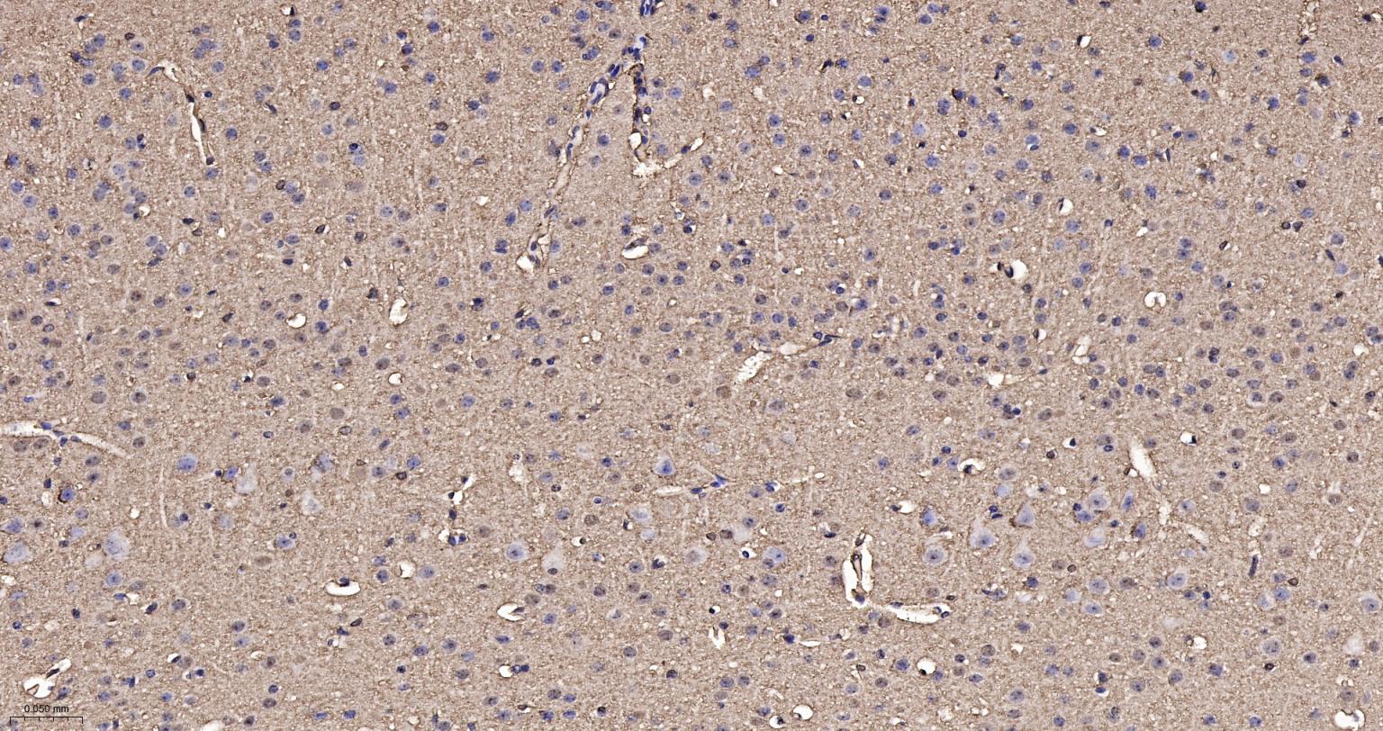 3-磷酸甘油醛脱氢酶(内参)重组兔单抗