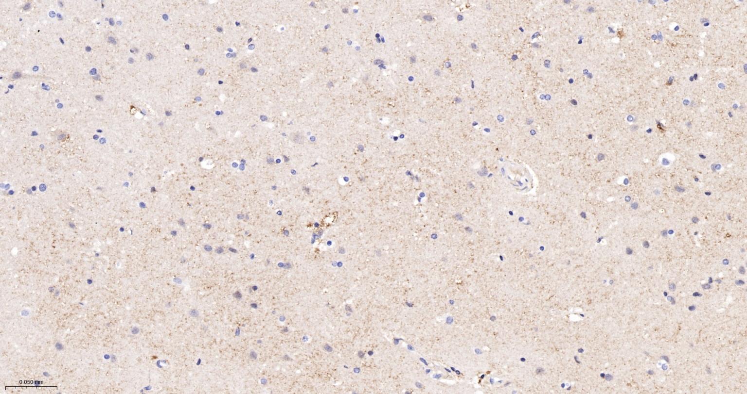 埃兹蛋白重组兔单抗-bsm-61424R