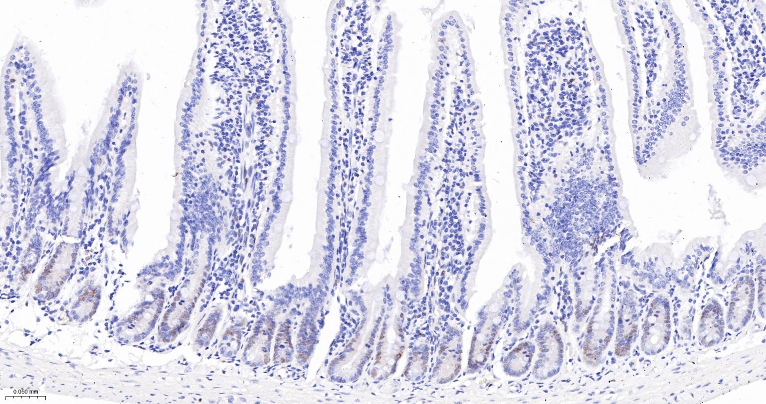周期素D1重组兔单抗