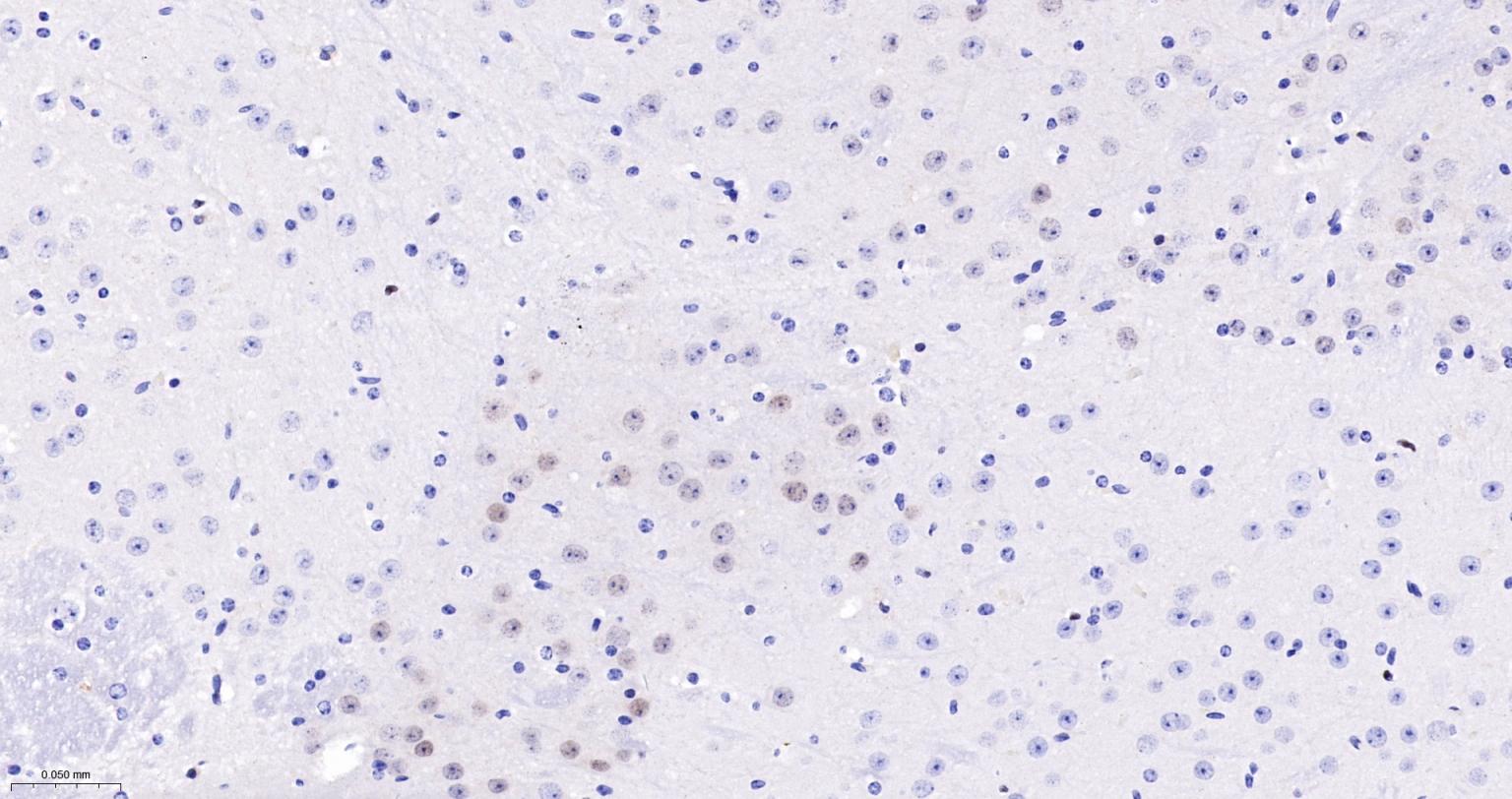 周期素D1重组兔单抗