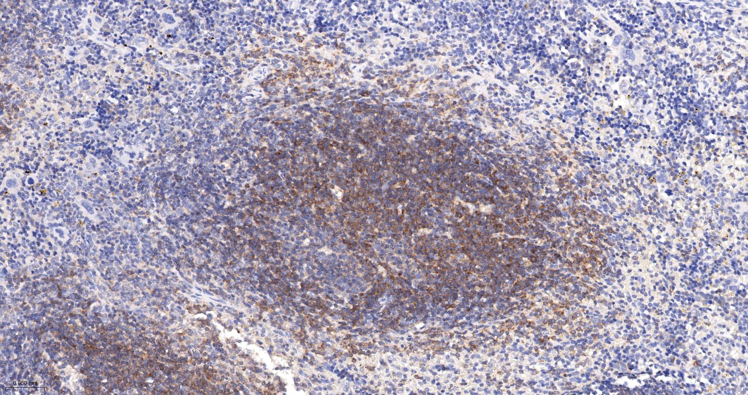 埃兹蛋白重组兔单抗-bsm-61424R