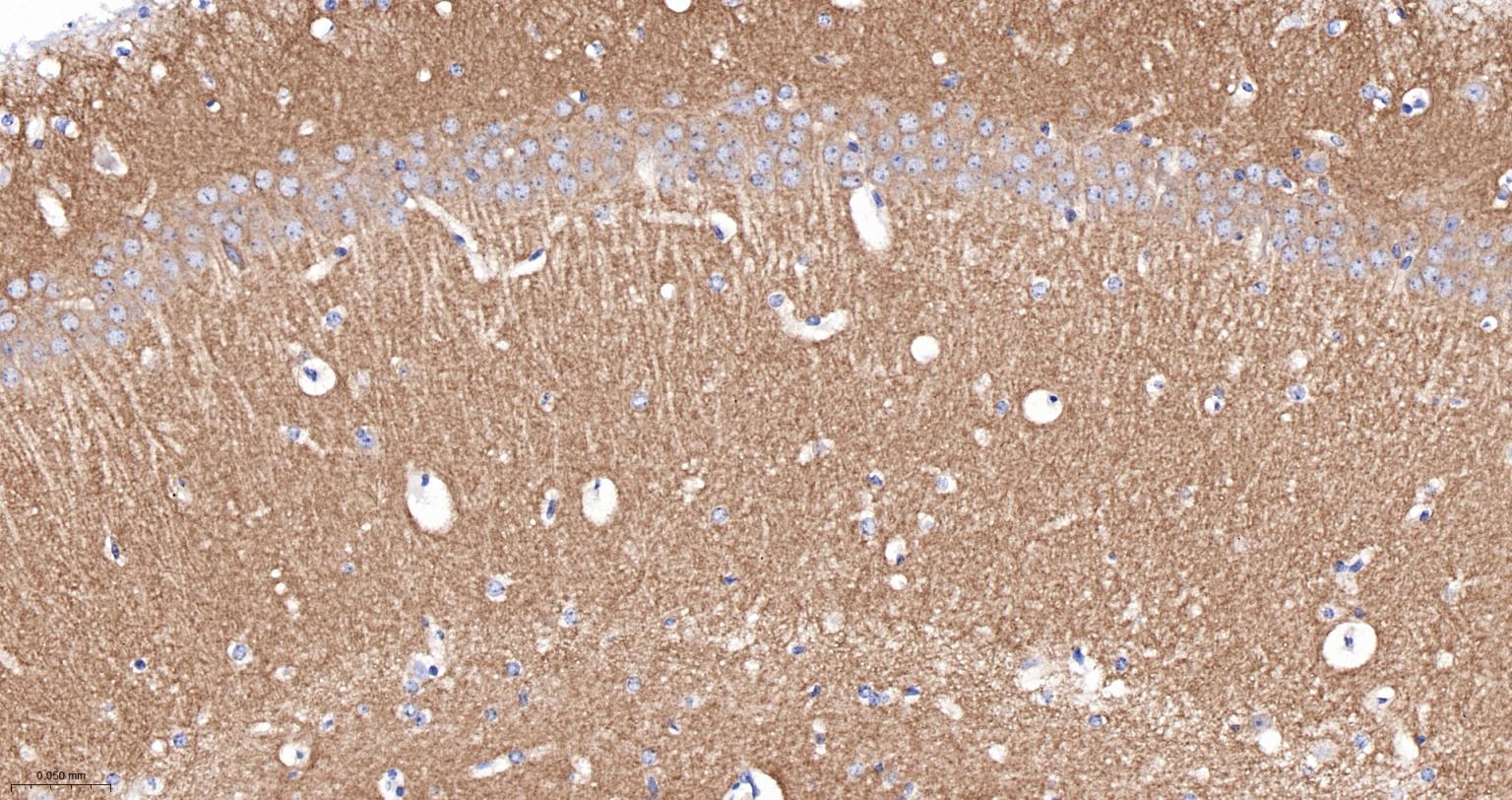 谷氨酸受体1重组兔单抗