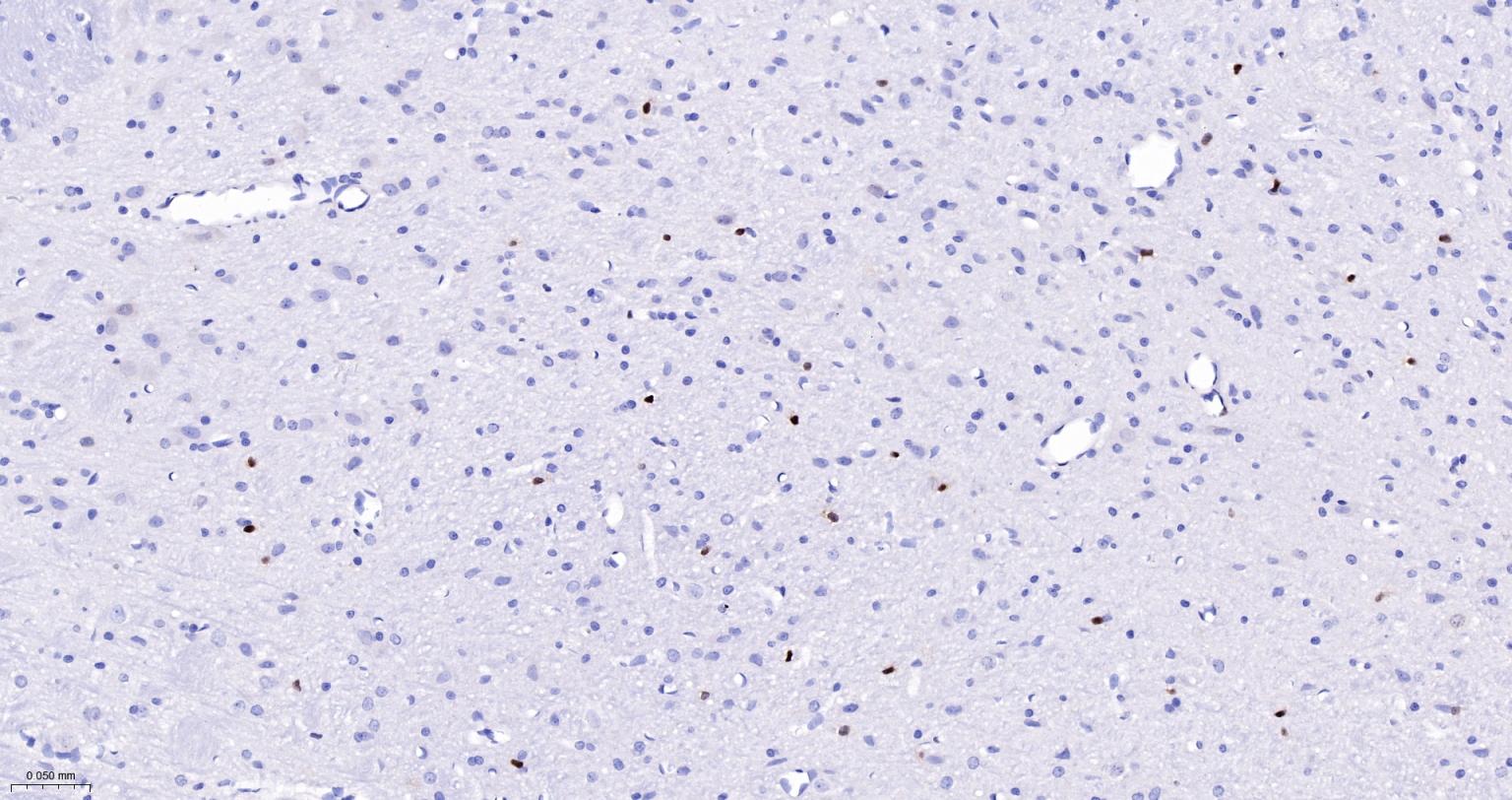 周期素D1重组兔单抗