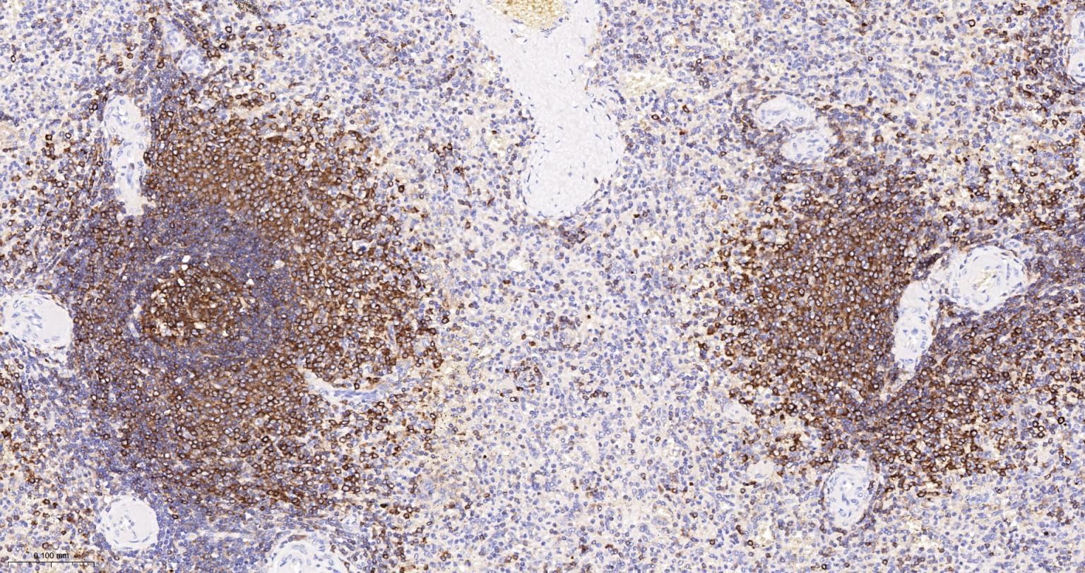 埃兹蛋白重组兔单抗-bsm-61424R