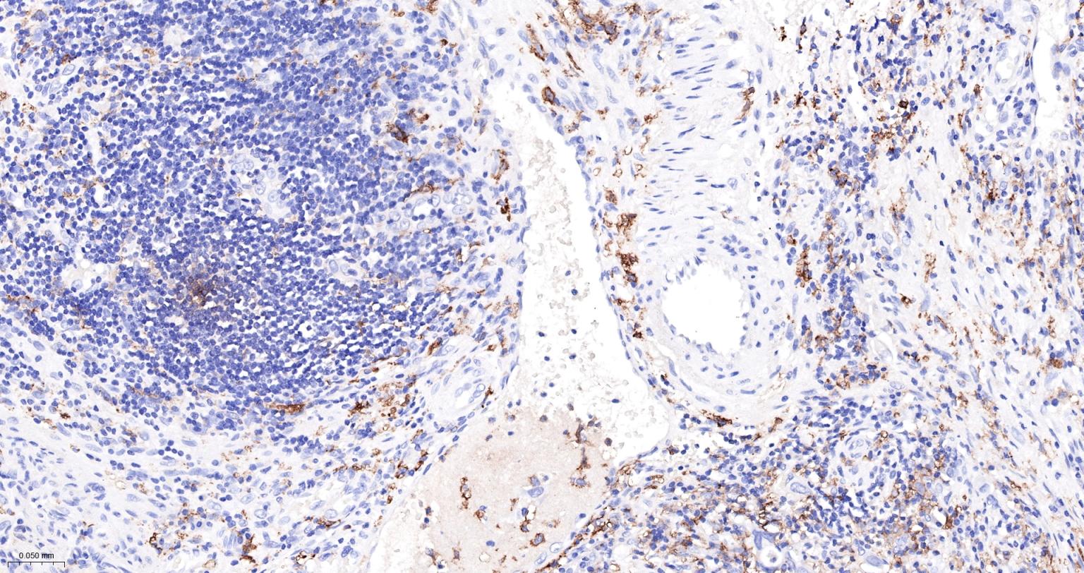 内毒素受体单克隆抗体-bsm-43686M