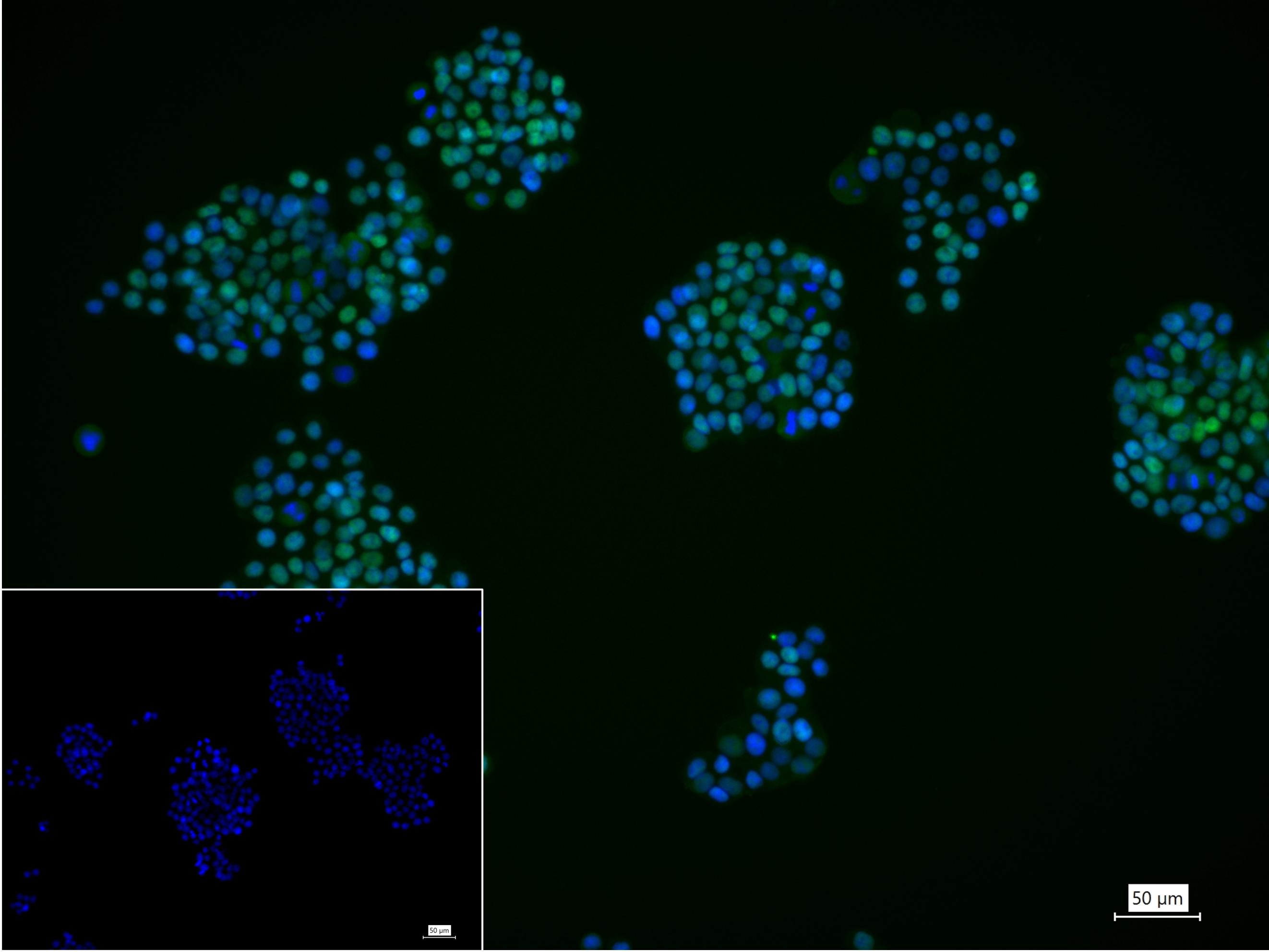 细胞肿瘤抗原P53重组兔单抗