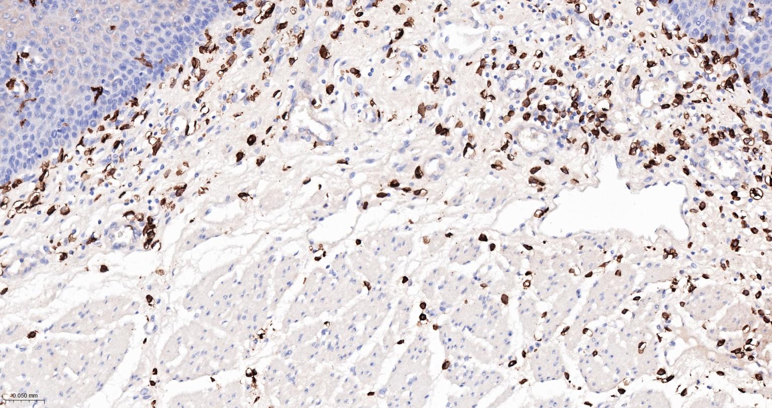 内毒素受体单克隆抗体-bsm-43686M