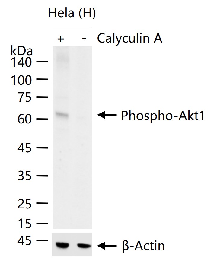 磷酸化蛋白激酶B重组兔单抗