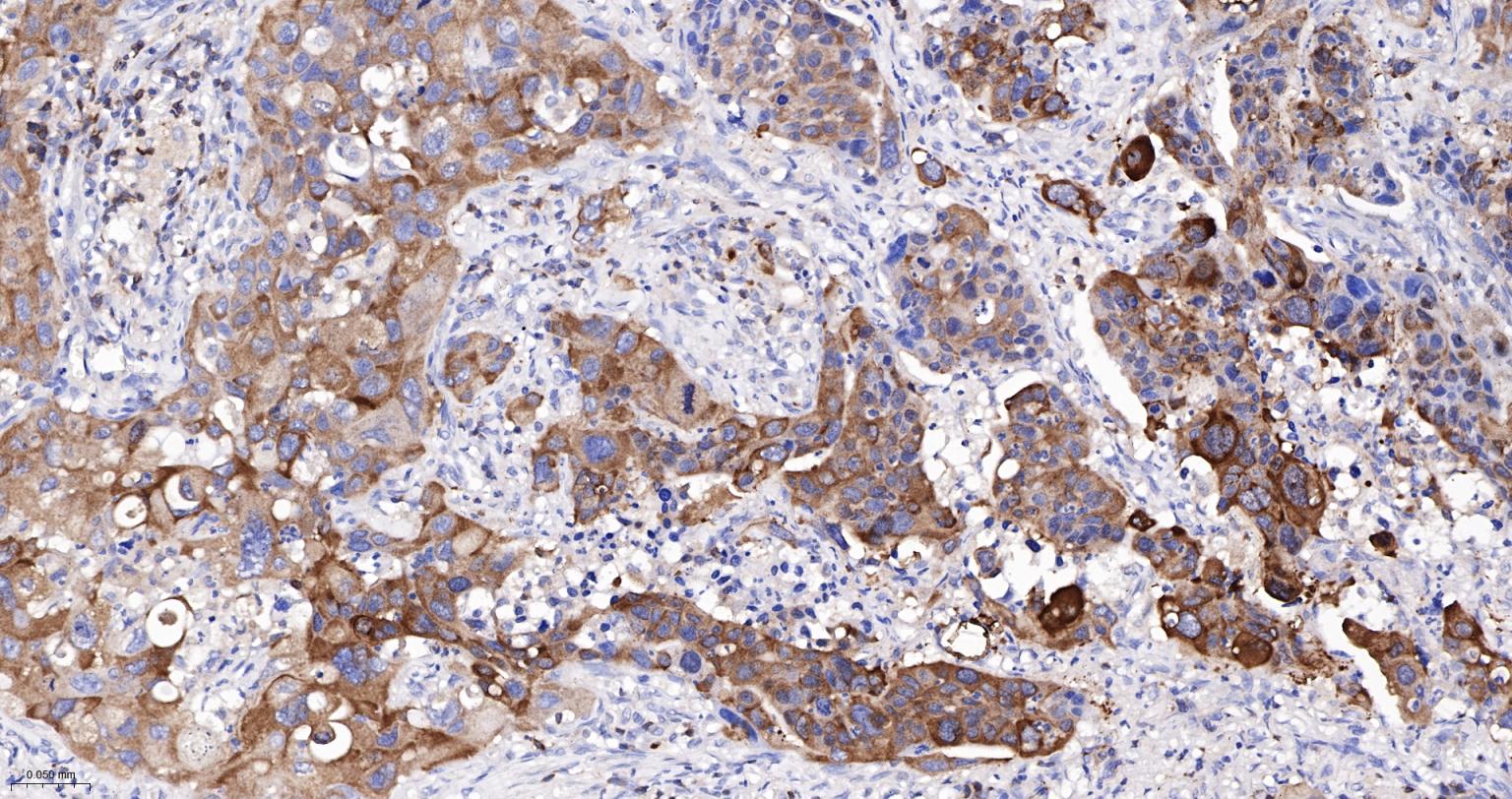 埃兹蛋白重组兔单抗-bsm-61424R