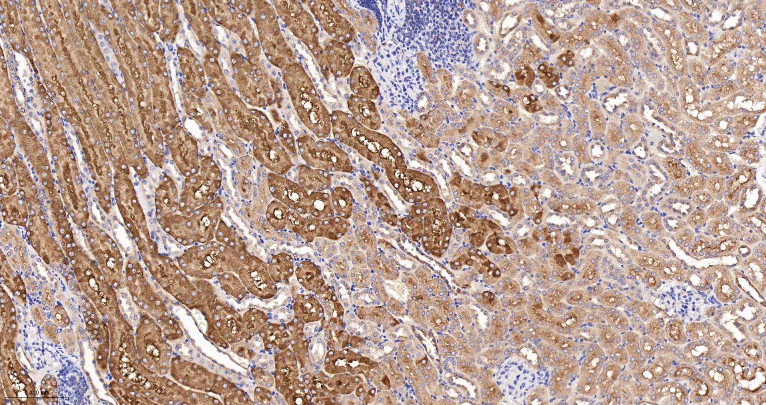 埃兹蛋白重组兔单抗-bsm-61424R