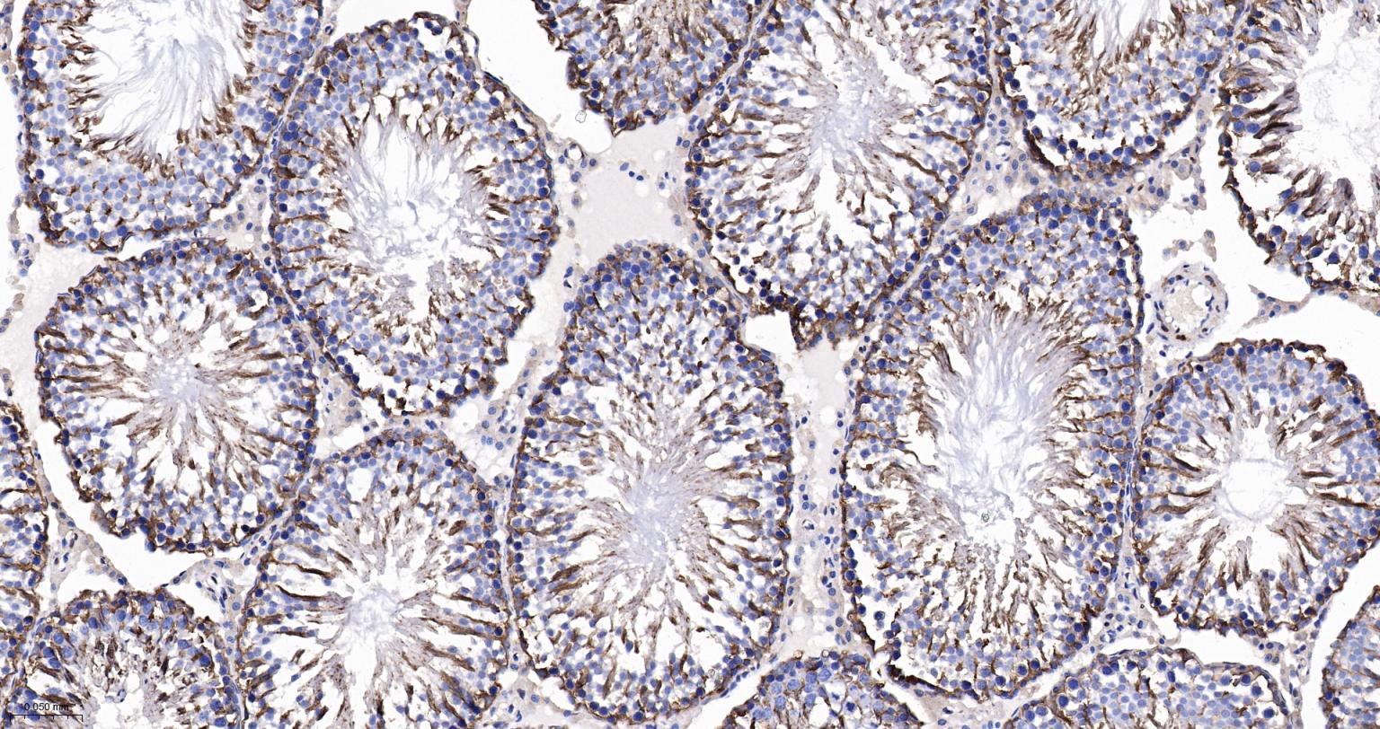 3-磷酸甘油醛脱氢酶(内参)重组兔单抗