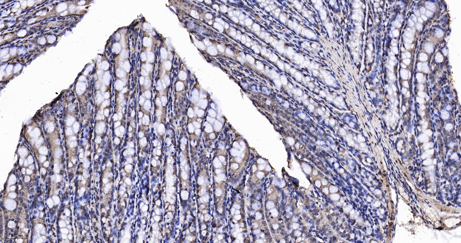 3-磷酸甘油醛脱氢酶(内参)重组兔单抗