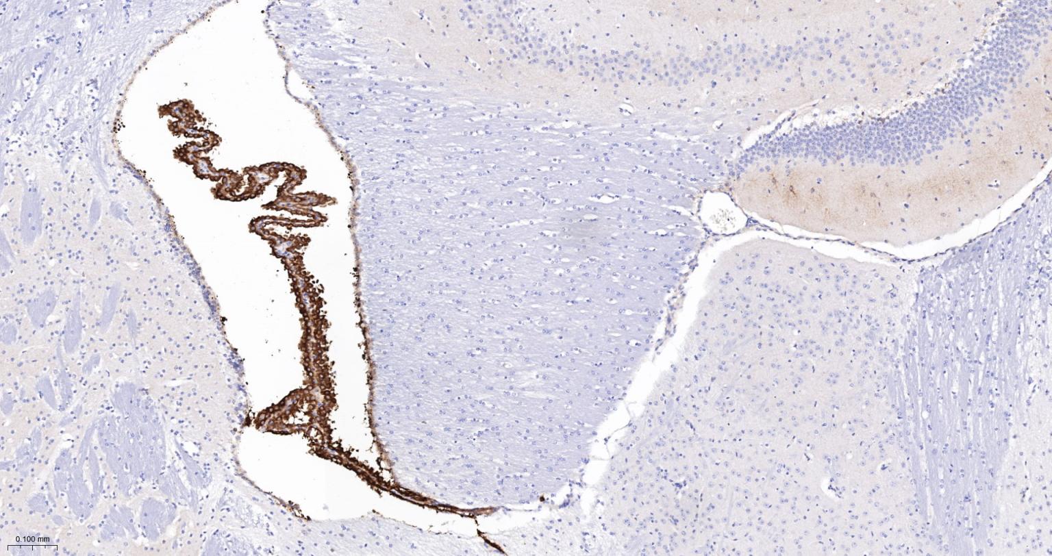 埃兹蛋白重组兔单抗-bsm-61424R