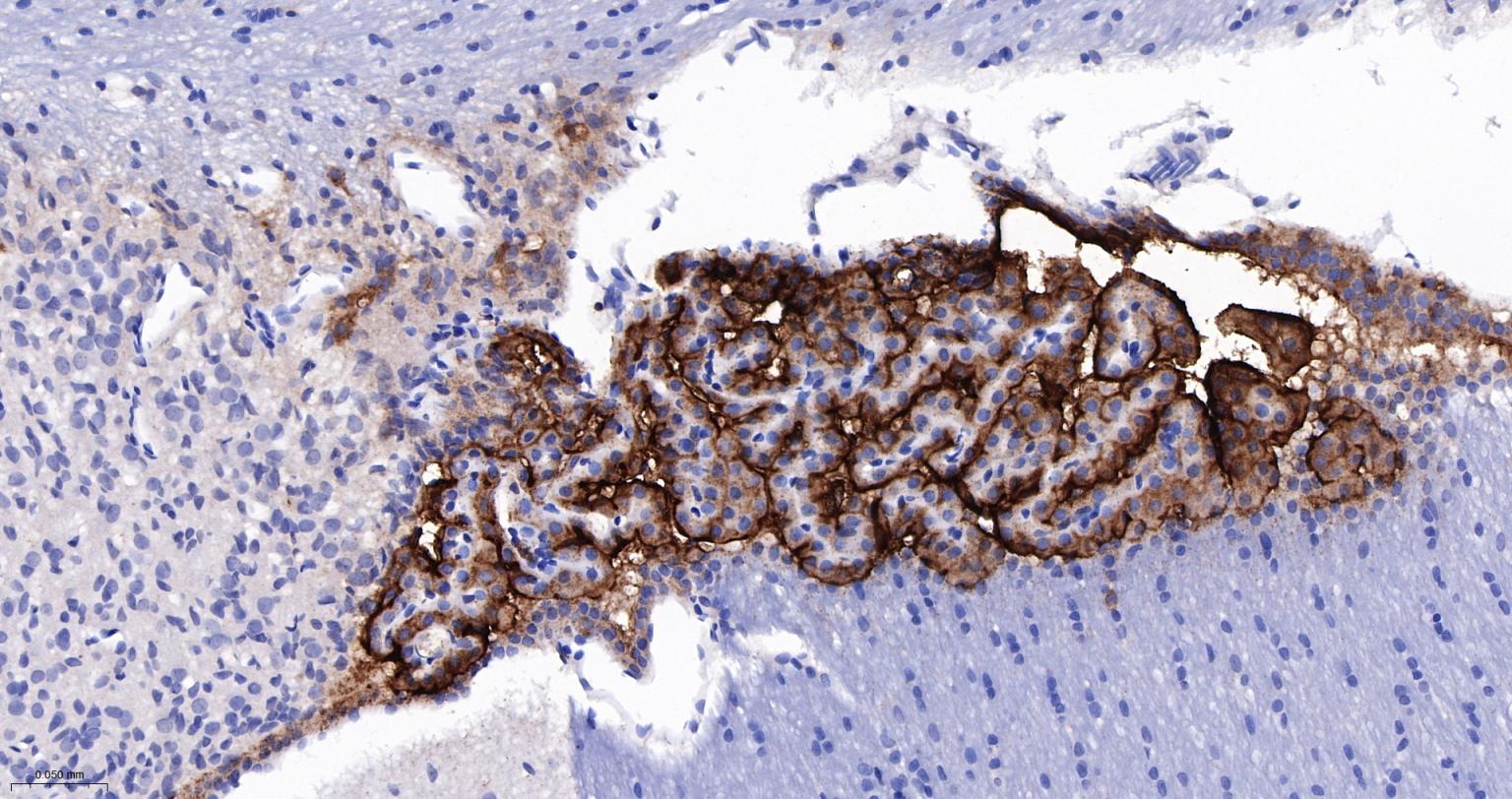 埃兹蛋白重组兔单抗-bsm-61424R