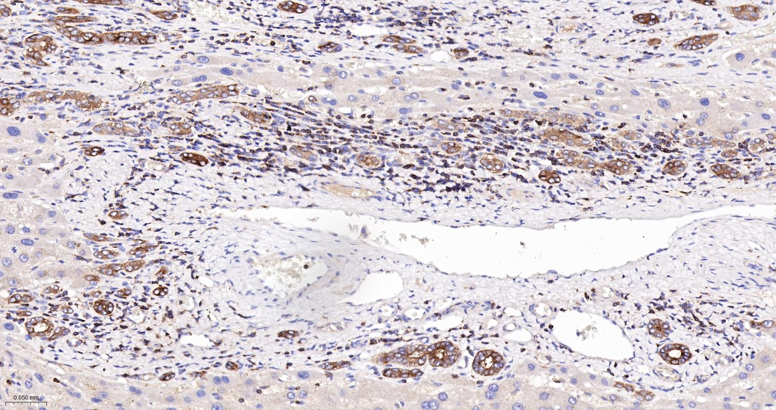埃兹蛋白重组兔单抗-bsm-61424R