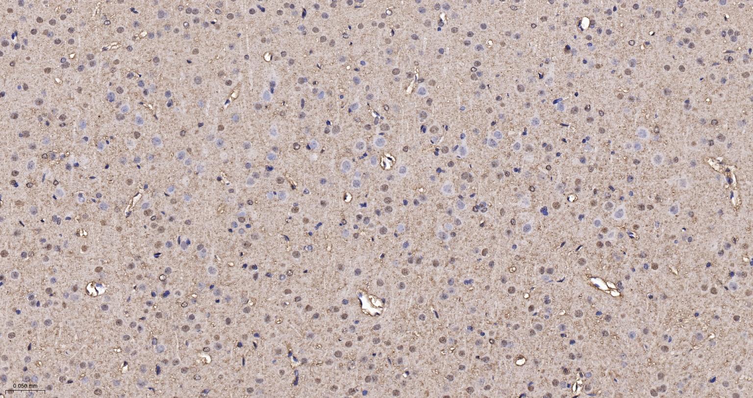 3-磷酸甘油醛脱氢酶(内参)重组兔单抗