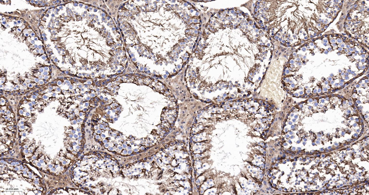 3-磷酸甘油醛脱氢酶(内参)重组兔单抗