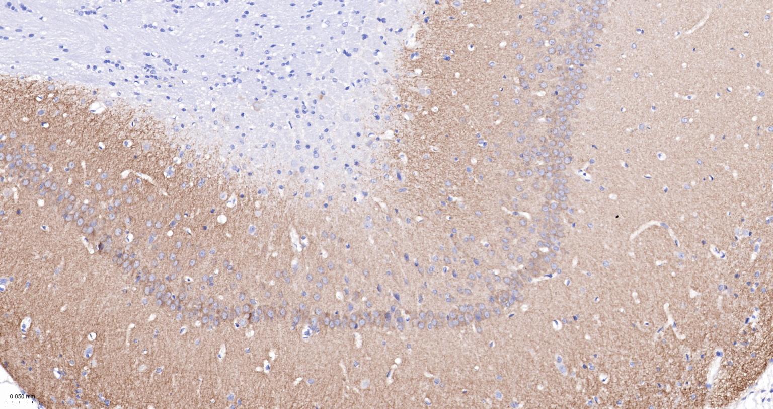 谷氨酸受体1重组兔单抗