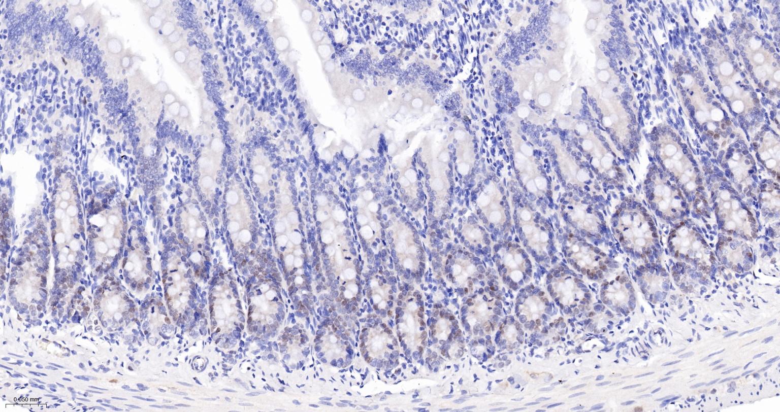 周期素D1重组兔单抗