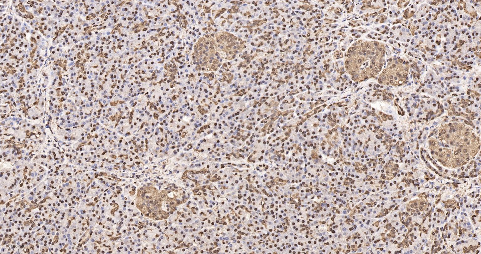 3-磷酸甘油醛脱氢酶(内参)重组兔单抗