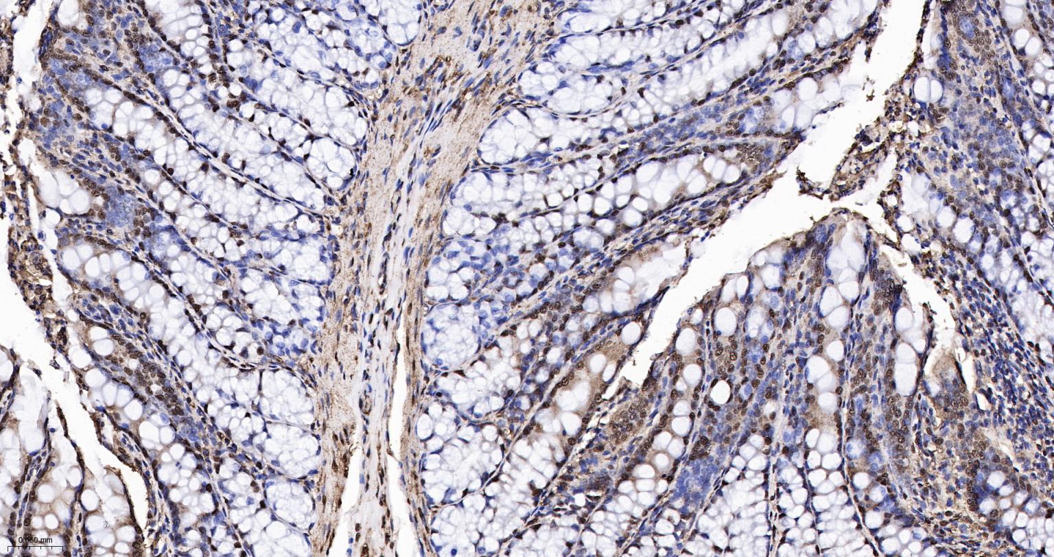3-磷酸甘油醛脱氢酶(内参)重组兔单抗