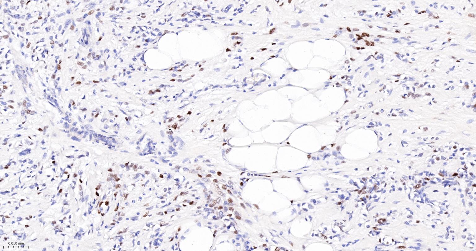 周期素D1重组兔单抗