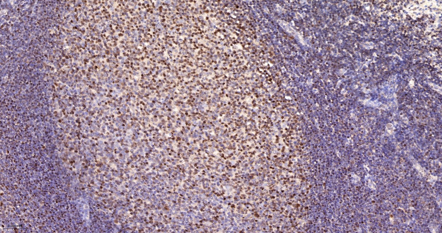 锌指蛋白Aiolos重组兔单抗-bsm-62807R