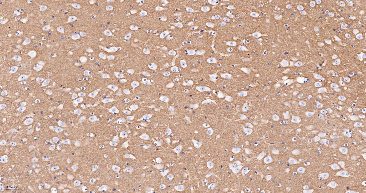 神经细胞粘附分子1重组兔单抗