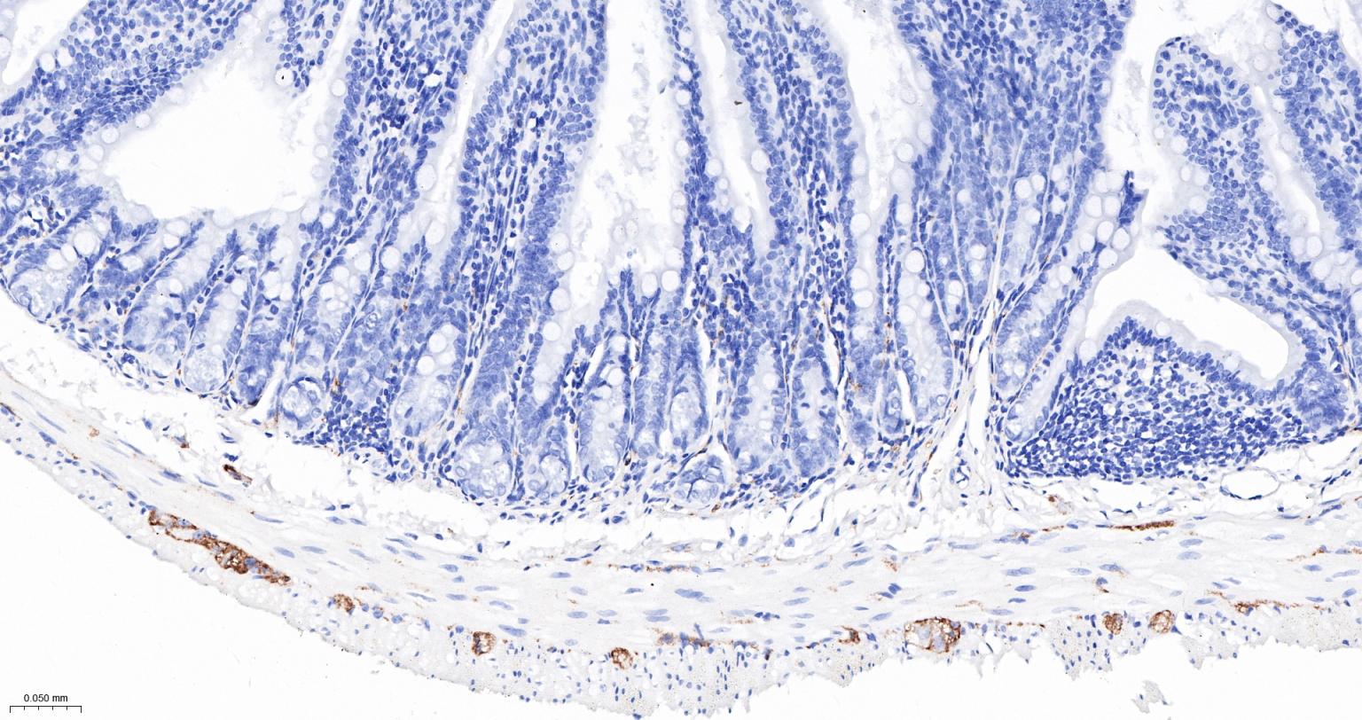 神经细胞粘附分子1重组兔单抗