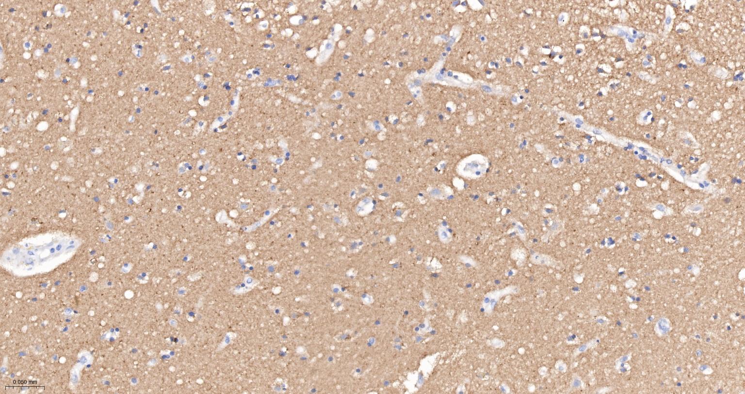 神经细胞粘附分子1重组兔单抗