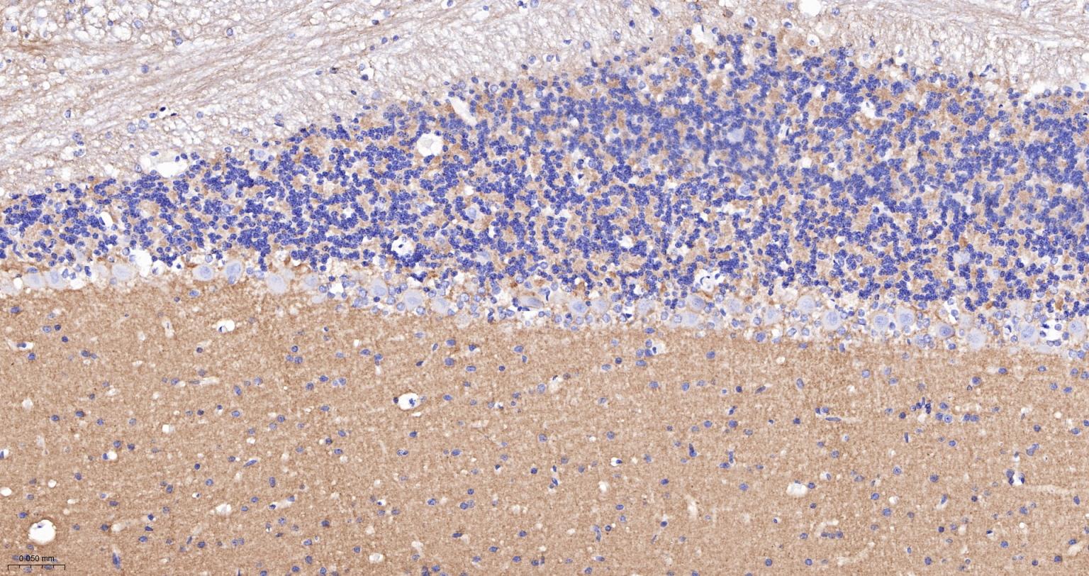 神经细胞粘附分子1重组兔单抗