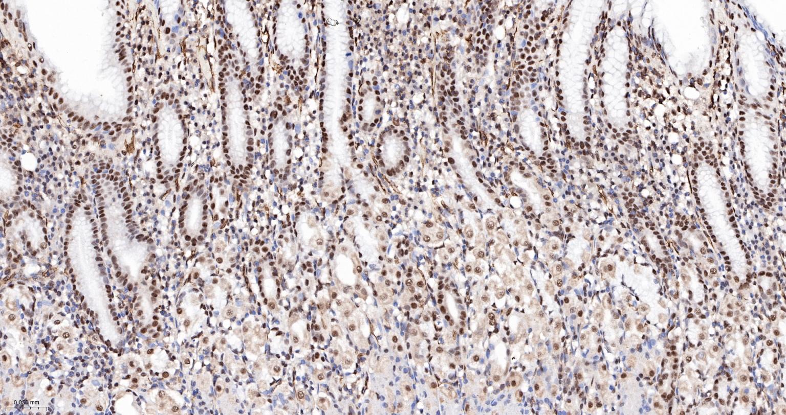 PRPF19重组兔单抗