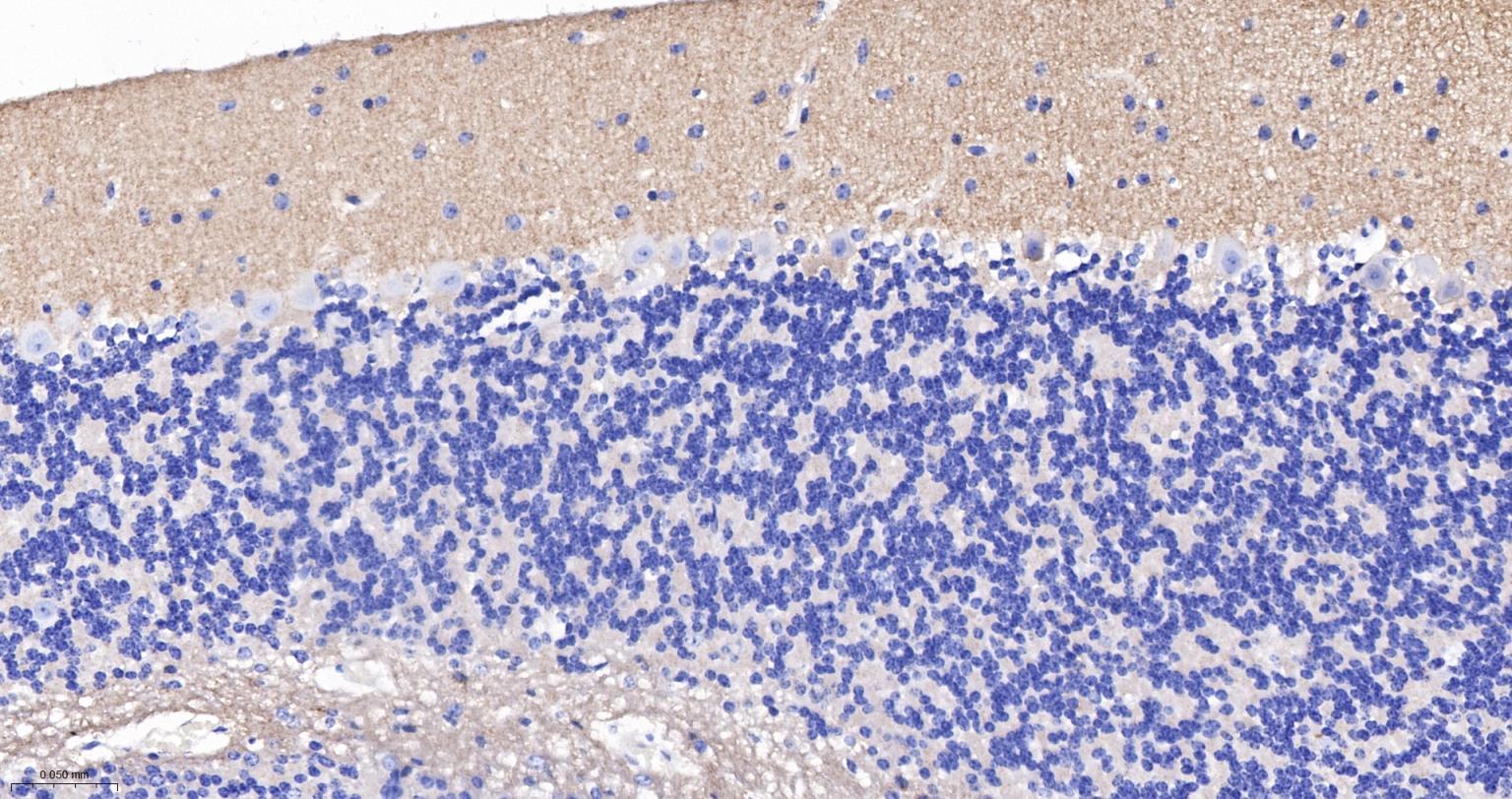 神经细胞粘附分子1重组兔单抗