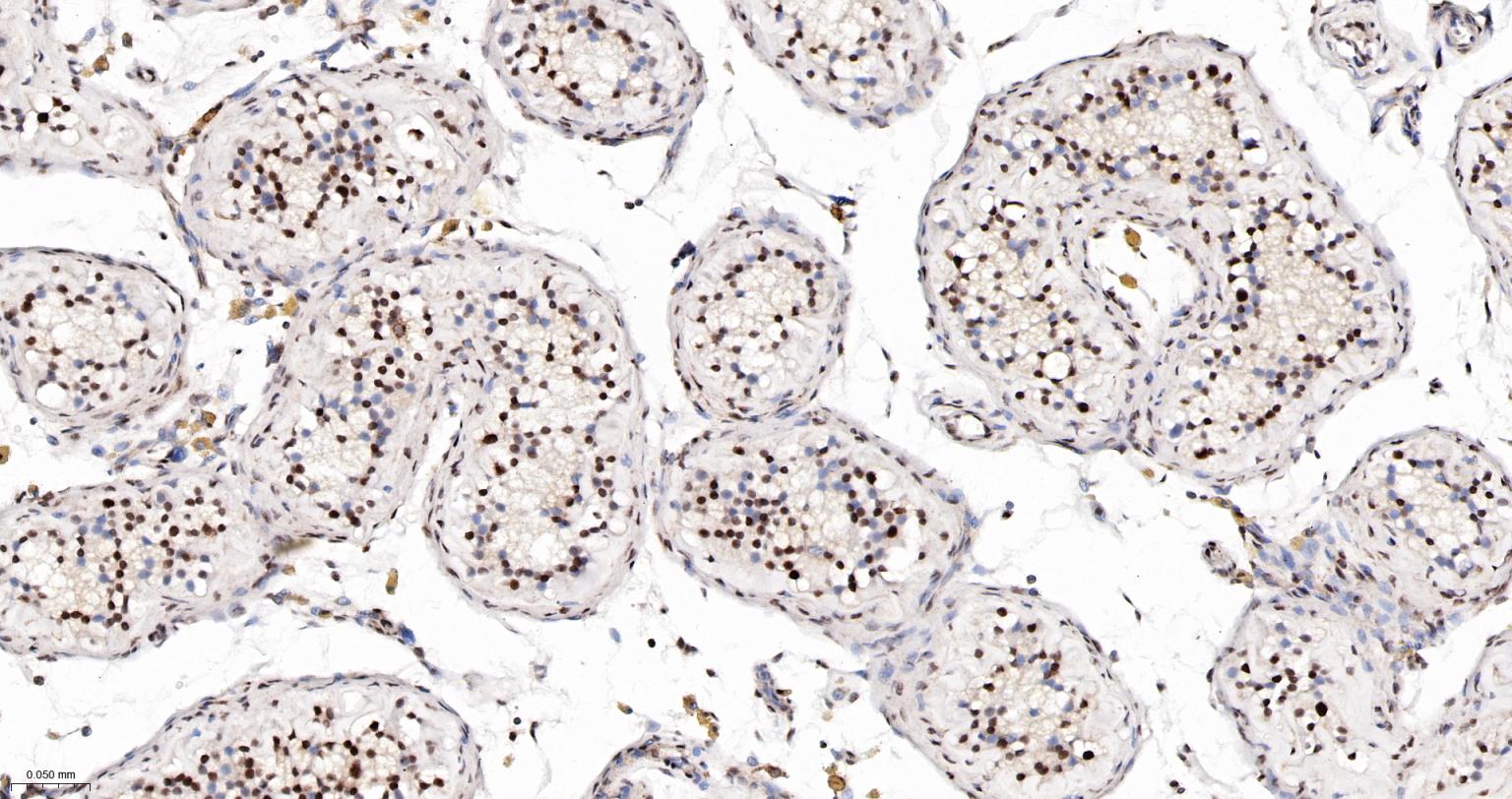PRPF19重组兔单抗