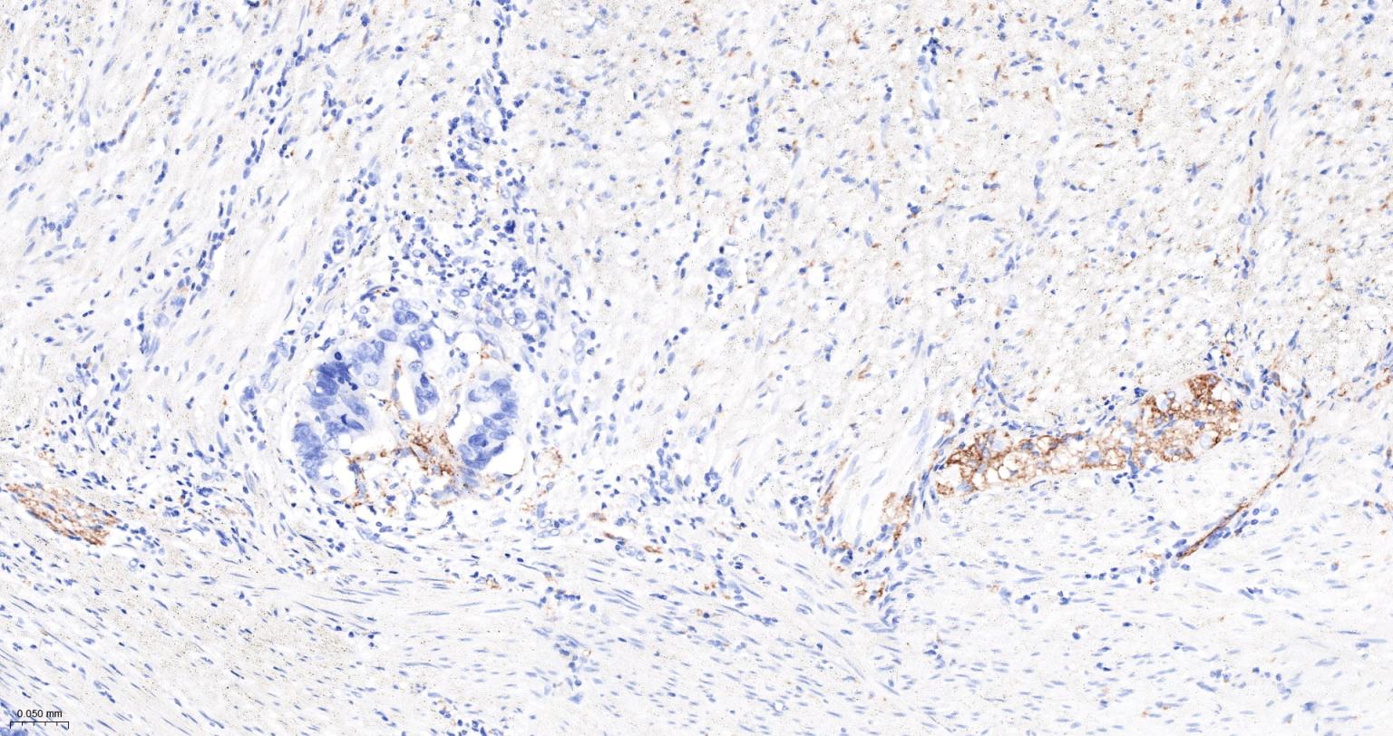 神经细胞粘附分子1重组兔单抗
