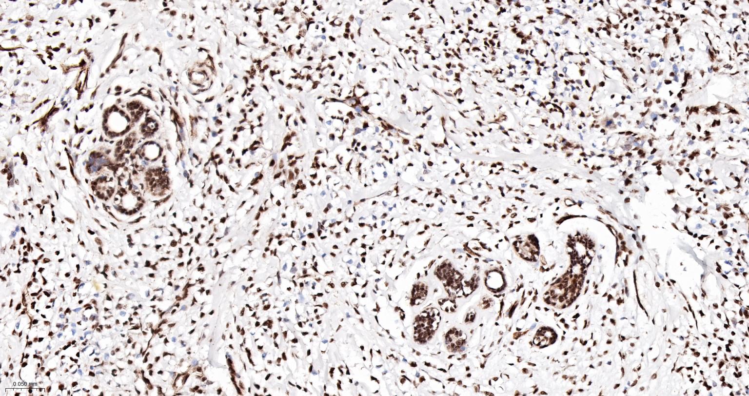 PRPF19重组兔单抗