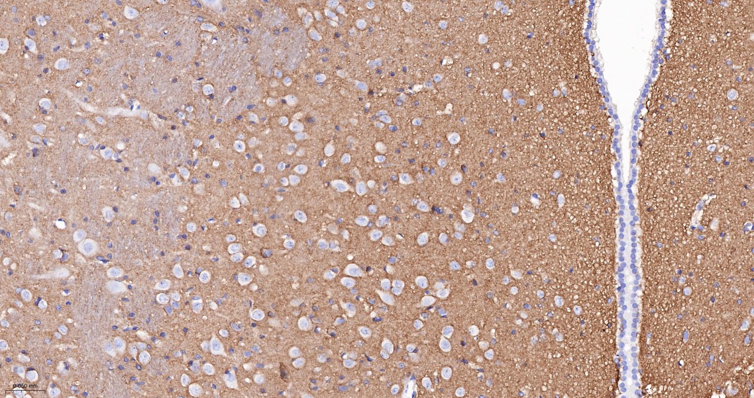 神经细胞粘附分子1重组兔单抗